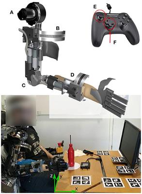 Eyes-Free Tongue Gesture and Tongue Joystick Control of a Five DOF Upper-Limb Exoskeleton for Severely Disabled Individuals